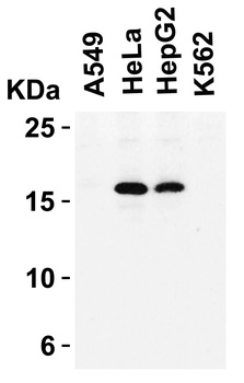 CDKN2A/p16INK4a Antibody