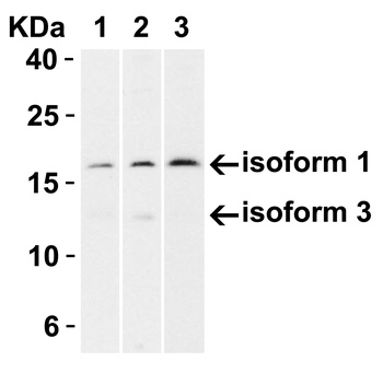 CDKN2A/p16INK4a Antibody