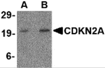 CDKN2A/p16INK4a Antibody