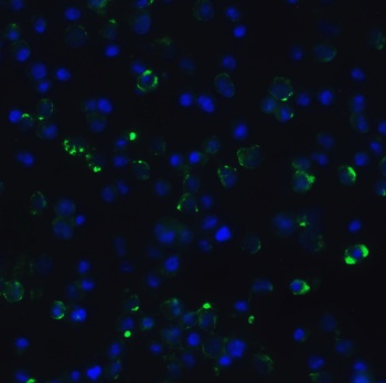 CDKN2A/p16INK4a Antibody