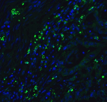 CDKN2A/p16INK4a Antibody