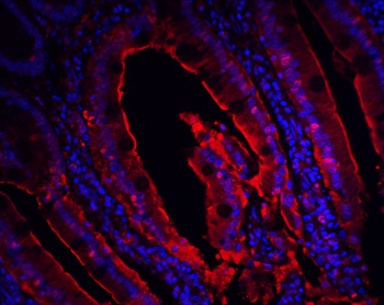 CDKN2A/p16INK4a Antibody