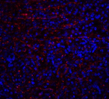 TNFRSF10A Antibody