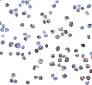 TNFRSF10A Antibody