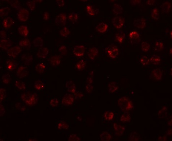 NDUFAF2 Antibody