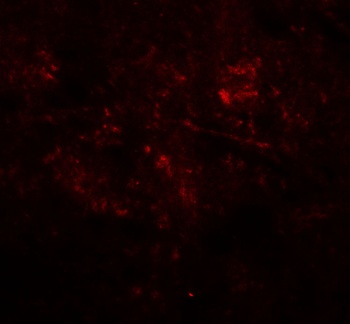 MAP2K1 Antibody