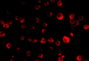 PCBP4 Antibody