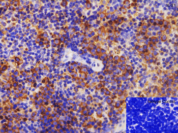 IL21 Antibody