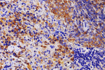 IL21 Antibody