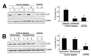 IL21 Antibody