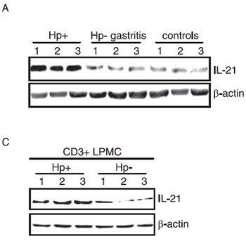 IL21 Antibody