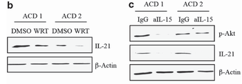 IL21 Antibody