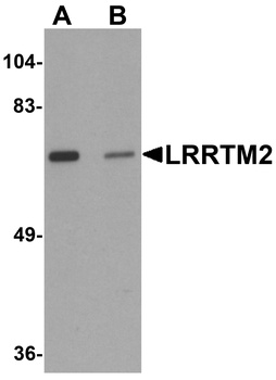 LRRTM2 Antibody
