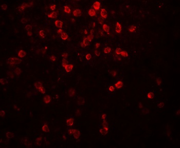 IL9 Antibody