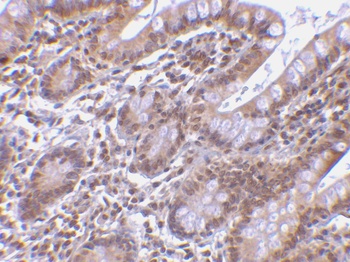 BIRC7 Antibody