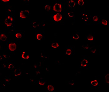 IRAK1 Antibody