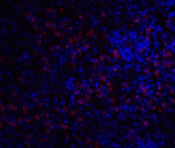 IRAK3 Antibody