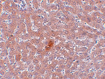 KDM3A Antibody