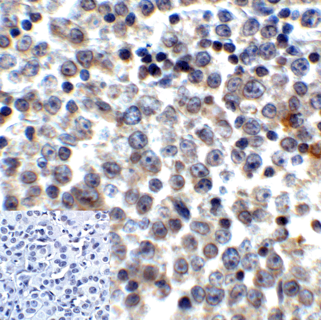 LAG3 Antibody