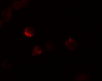 LIF Antibody
