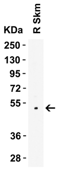 LMX1A Antibody