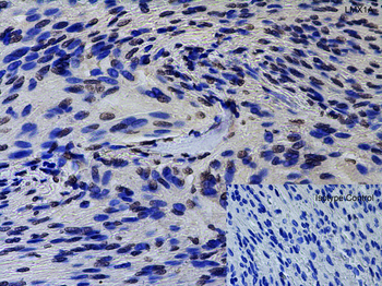 LMX1A Antibody