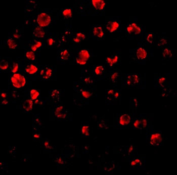 IRAK2 Antibody