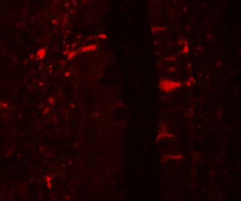 IL36RN Antibody
