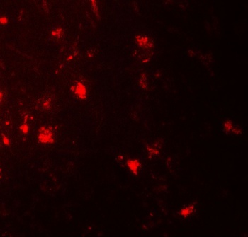 IL36A Antibody