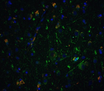 NRTN Antibody