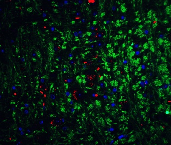 NRTN Antibody