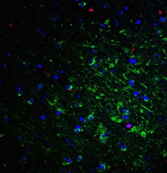 RTN4 Antibody