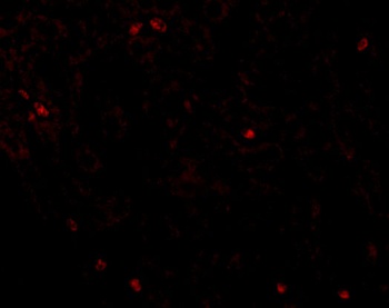 OCLN Antibody