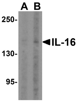 IL16 Antibody