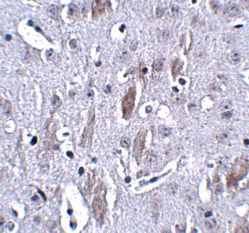 IL16 Antibody