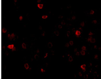 IL16 Antibody