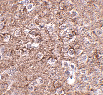 IL16 Antibody