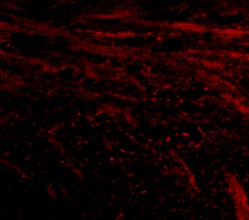 IL16 Antibody