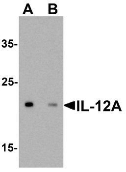 IL 12A Antibody
