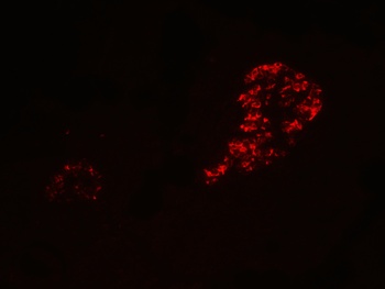 IL 12A Antibody