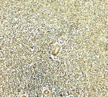 IKZF2 Antibody