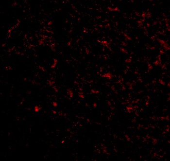 GRIK5 Antibody