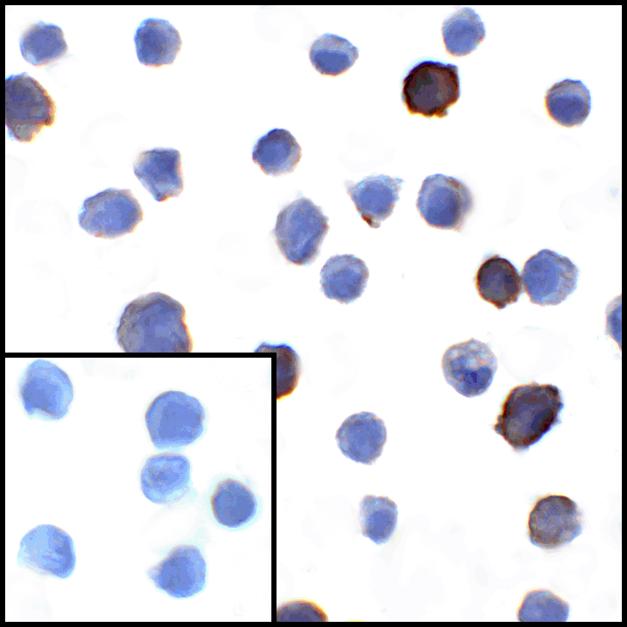 CD274 Antibody