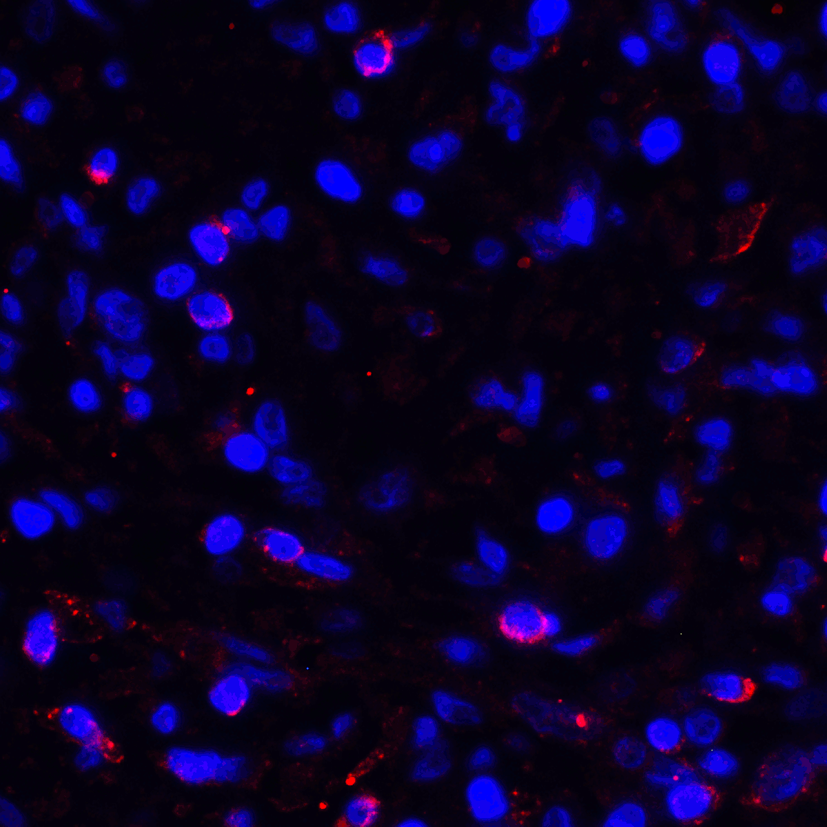 CD274 Antibody