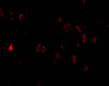 PDCD1LG2 Antibody