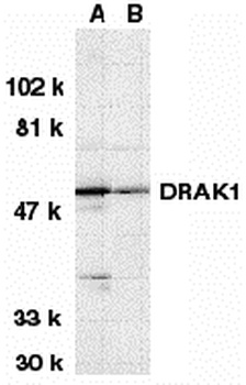 STK17A Antibody