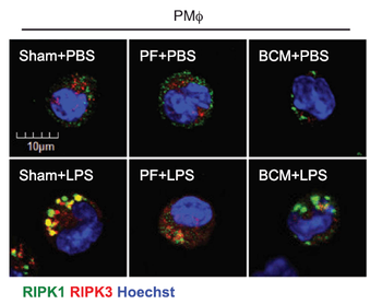 Ripk3 Antibody