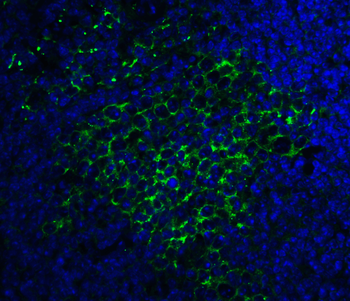 SQSTM1 Antibody