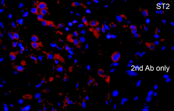 Il1rl1 Antibody