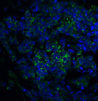 Il1rl1 Antibody